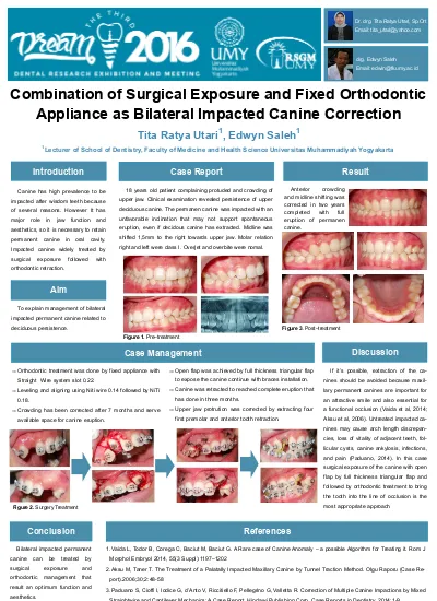 Combination of Surgical exposure and fixed orthodontic appliance as ...