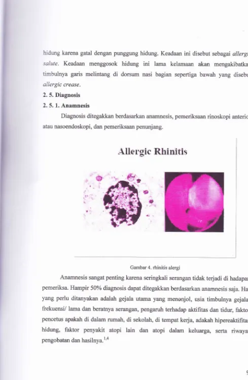 cara sembuh dari rhinitis alergi