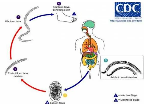 A pinworms károsítják a testet - Paraziták az emberi testben, pinworms