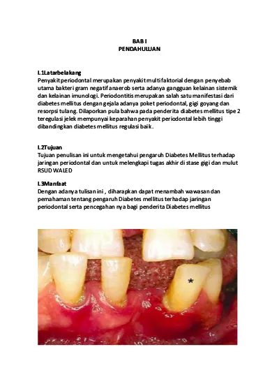 Gejala penyakit periodontium